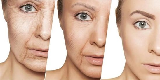 Causes Of Wrinkles And Fine Lines